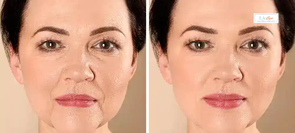 Why Aren’t My Skincare Products Making My Sagging Skin Look Firmer Bognor Regis?